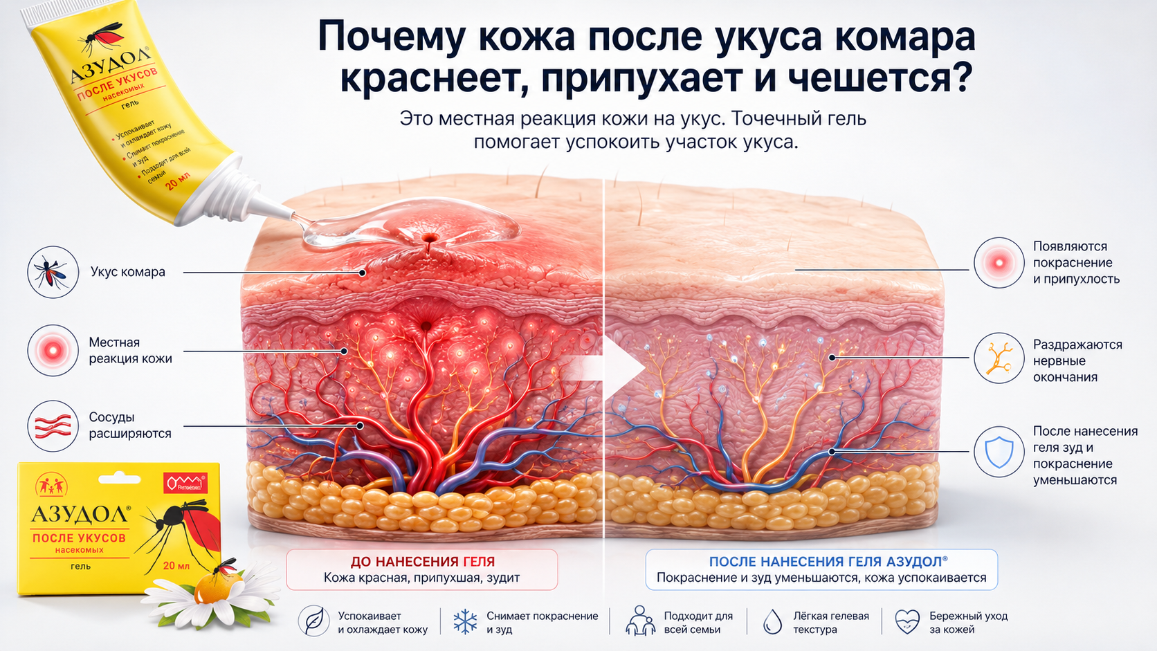 Азудол, гель после укусов комаров, тело, зуд